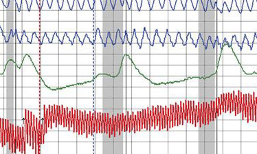 learn polygraph faster